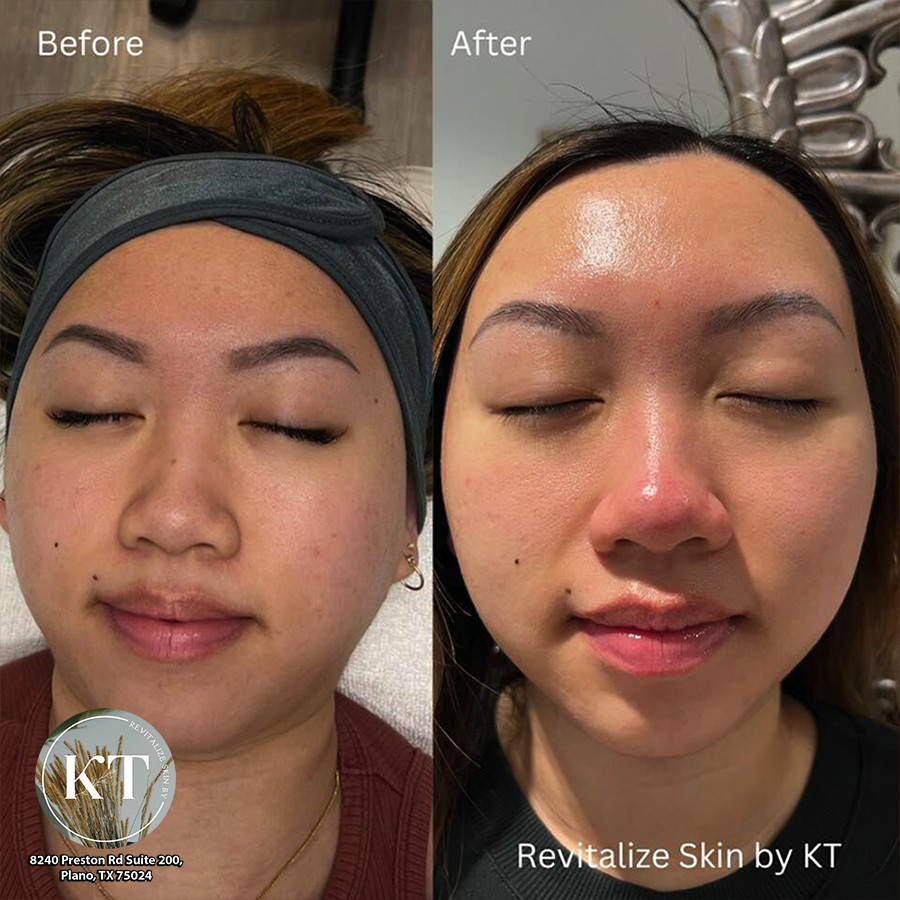 REVITALIZE SKIN BY KT - Best day spa Plano, TX 75024